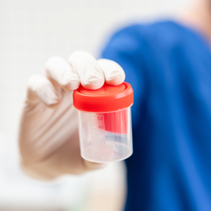urine THCa test - How long does THCa stay in your system